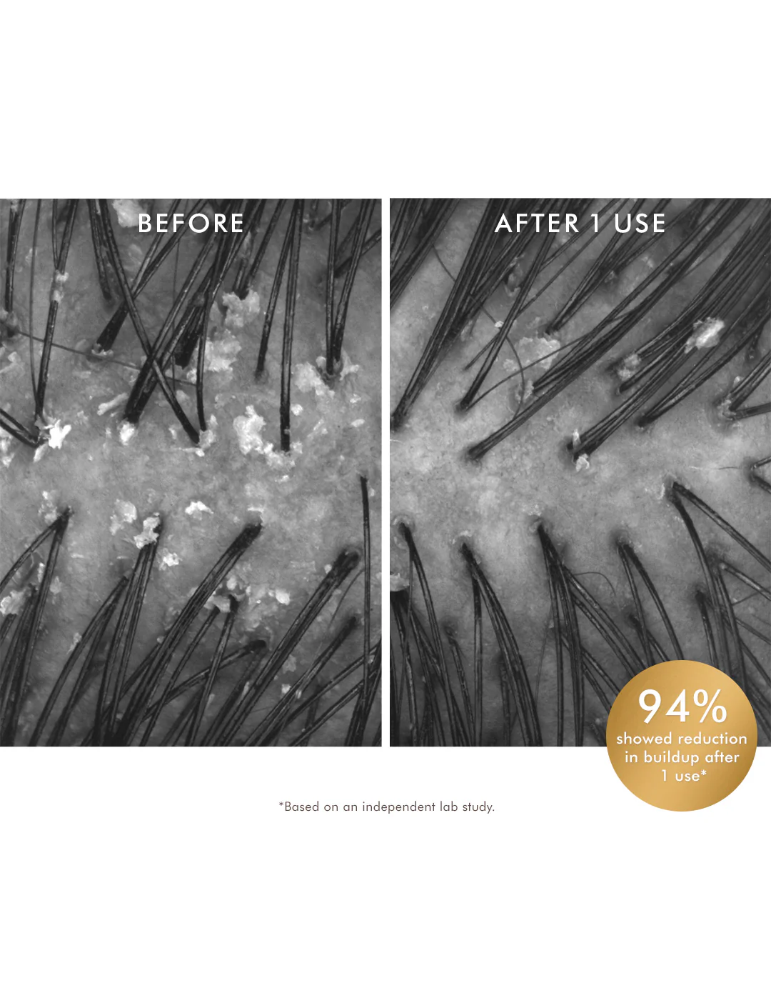 Purifying Pre-Wash Scalp Scrub - Image 3